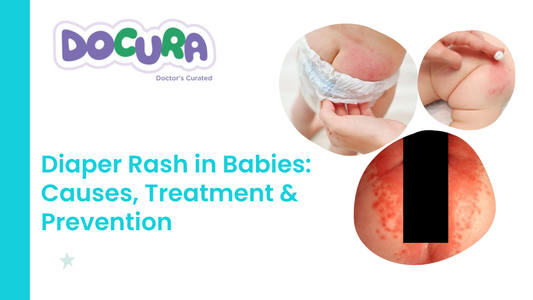 Diaper Rash in Babies: Causes, Treatment & Prevention