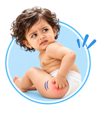 Baby Rashes