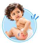 Baby Rashes