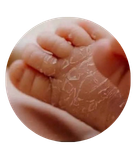 Dry Skin